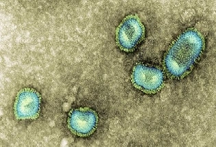 Human Metapneumovirus:  कोविड सारखी लक्षणांसह एक नवीन विषाणूजन्य संसर्ग उदभवला