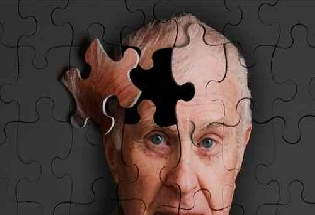 World Alzheimer Day : वर्ल्ड अल्झायमर डे