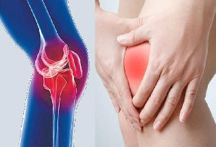 Knee Replacement Surgery गुडघा बदलणे धोकादायक आहे का?
