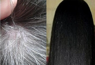 white pubic hair या 6 कारणांमुळे जघनाचे केस अकाली पांढरे होऊ शकतात, दुर्लक्ष करू नका